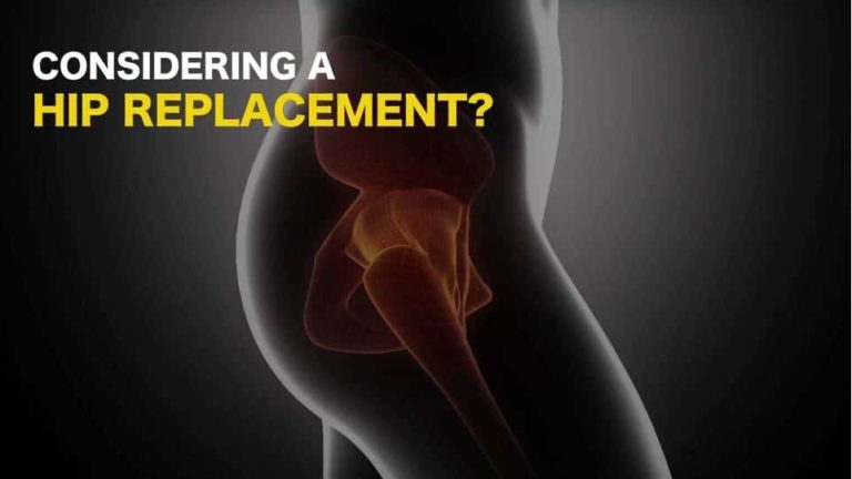 tips-to-avoid-a-hip-replacement-video-healthstar-clinic